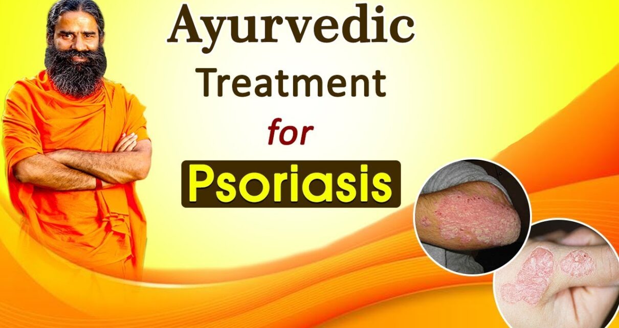 Patanjali Psoriasis Treatment 2025